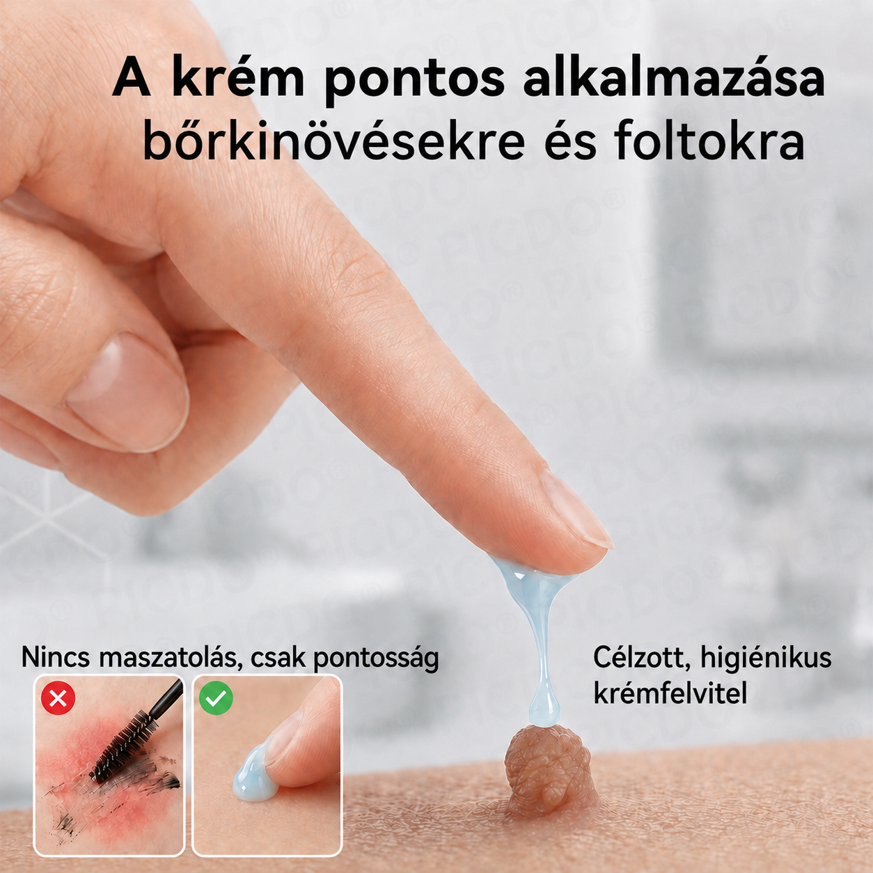 Picdo® 7‑denní krém k odstraňování kožních výrůstků a pigmentových skvrn 🧴(𝐒𝐜𝐡𝐦𝐞𝐫𝐳𝐟𝐫𝐞𝐢𝐞 𝐅𝐨𝐫𝐦𝐞𝐥 – 𝐨𝐡𝐧𝐞 𝐍𝐚𝐫𝐛𝐞𝐧) 💧