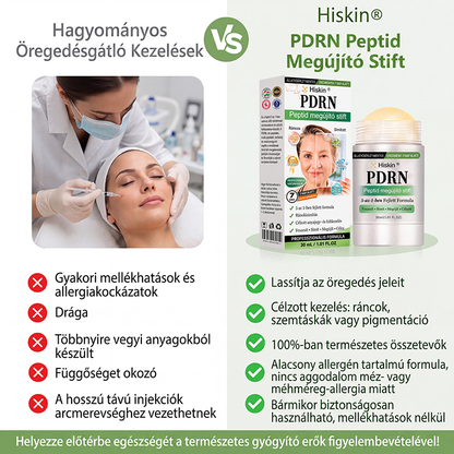 𝑯𝒊𝒔𝒌𝒊𝒏®  𝑷𝑫𝑹𝑵 Ö𝒓𝒆𝒈𝒆𝒅é𝒔𝒈á𝒕𝒍ó & 𝑪é𝒍𝒛𝒐𝒕𝒕 𝑭𝒐𝒍𝒕𝒎𝒆𝒈ú𝒋í𝒕ó 𝑺𝒕𝒊𝒇𝒕（𝑺𝒆𝒈í𝒕 𝒌𝒊𝒔𝒊𝒎í𝒕𝒂𝒏𝒊 𝒂 𝒓á𝒏𝒄𝒐𝒌 𝒎𝒆𝒈𝒋𝒆𝒍𝒆𝒏é𝒔é𝒕, 𝒕á𝒎𝒐𝒈𝒂𝒕𝒋𝒂 𝒂 𝒇𝒆𝒔𝒛𝒆𝒔𝒆𝒃𝒃𝒏𝒆𝒌 𝒕ű𝒏ő 𝒃ő𝒓𝒕, é𝒔 𝒔𝒆𝒈í𝒕 𝒋𝒂𝒗í𝒕𝒂𝒏𝒊 𝒂 𝒍á𝒕𝒉𝒂𝒕ó 𝒇𝒐𝒍𝒕𝒐𝒌 𝒎𝒆𝒈𝒋𝒆𝒍𝒆𝒏é𝒔é𝒕）🍈