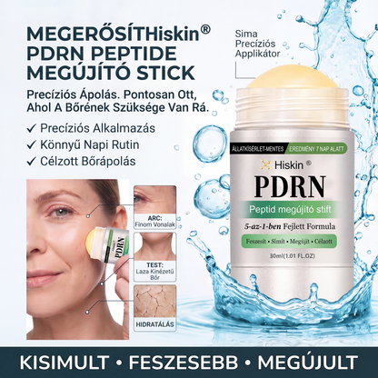 𝑯𝒊𝒔𝒌𝒊𝒏®  𝑷𝑫𝑹𝑵 Ö𝒓𝒆𝒈𝒆𝒅é𝒔𝒈á𝒕𝒍ó & 𝑪é𝒍𝒛𝒐𝒕𝒕 𝑭𝒐𝒍𝒕𝒎𝒆𝒈ú𝒋í𝒕ó 𝑺𝒕𝒊𝒇𝒕（𝑺𝒆𝒈í𝒕 𝒌𝒊𝒔𝒊𝒎í𝒕𝒂𝒏𝒊 𝒂 𝒓á𝒏𝒄𝒐𝒌 𝒎𝒆𝒈𝒋𝒆𝒍𝒆𝒏é𝒔é𝒕, 𝒕á𝒎𝒐𝒈𝒂𝒕𝒋𝒂 𝒂 𝒇𝒆𝒔𝒛𝒆𝒔𝒆𝒃𝒃𝒏𝒆𝒌 𝒕ű𝒏ő 𝒃ő𝒓𝒕, é𝒔 𝒔𝒆𝒈í𝒕 𝒋𝒂𝒗í𝒕𝒂𝒏𝒊 𝒂 𝒍á𝒕𝒉𝒂𝒕ó 𝒇𝒐𝒍𝒕𝒐𝒌 𝒎𝒆𝒈𝒋𝒆𝒍𝒆𝒏é𝒔é𝒕）🍈