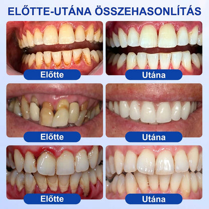 Evolvion® 🦷 GumRevive Ínyregeneráló Gél – Az egészségesebb ínyért és magabiztosabb mosolyért 🥰