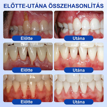 Evolvion® 🦷 GumRevive Ínyregeneráló Gél – Az egészségesebb ínyért és magabiztosabb mosolyért 🥰