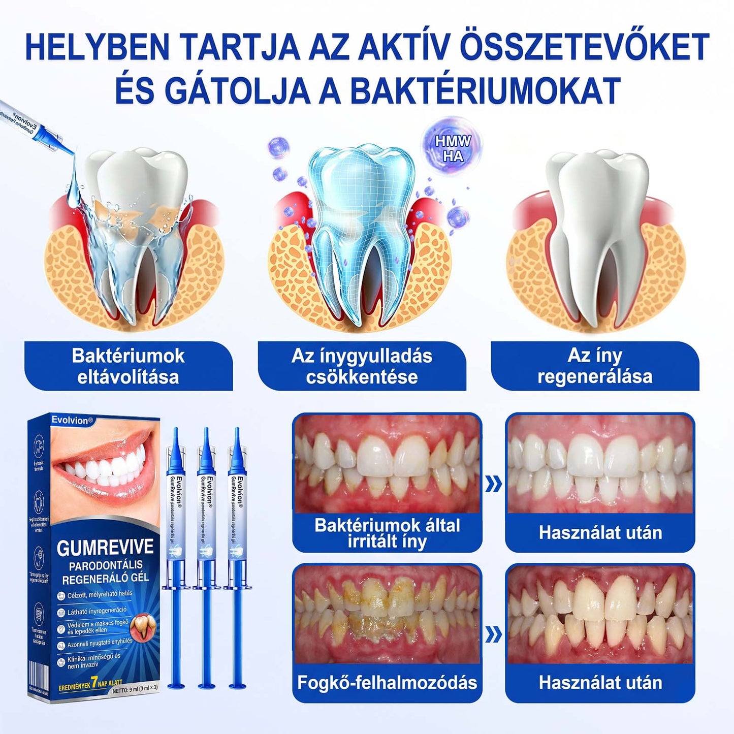 Evolvion® 🦷 GumRevive Ínyregeneráló Gél – Az egészségesebb ínyért és magabiztosabb mosolyért 🥰