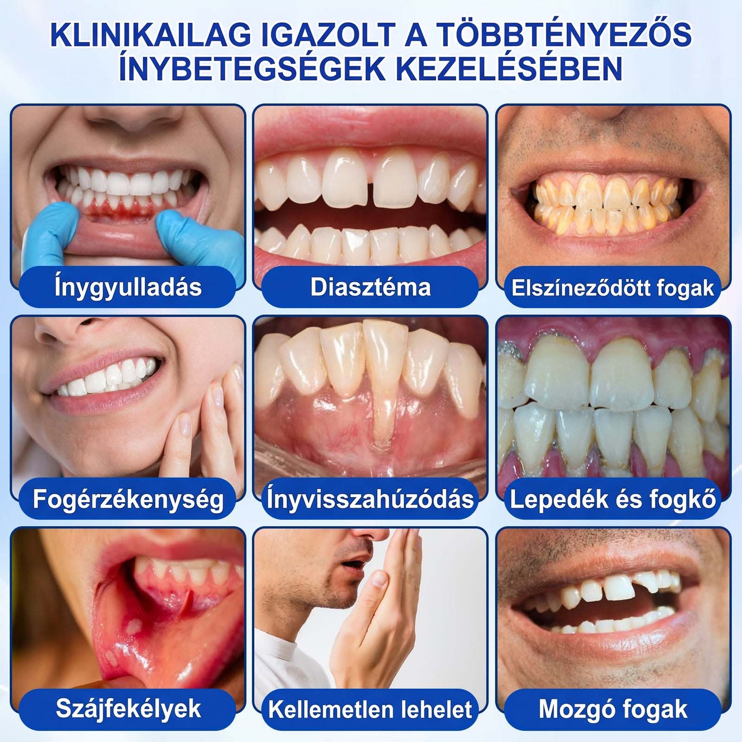 Evolvion® 🦷 GumRevive Ínyregeneráló Gél – Az egészségesebb ínyért és magabiztosabb mosolyért 🥰