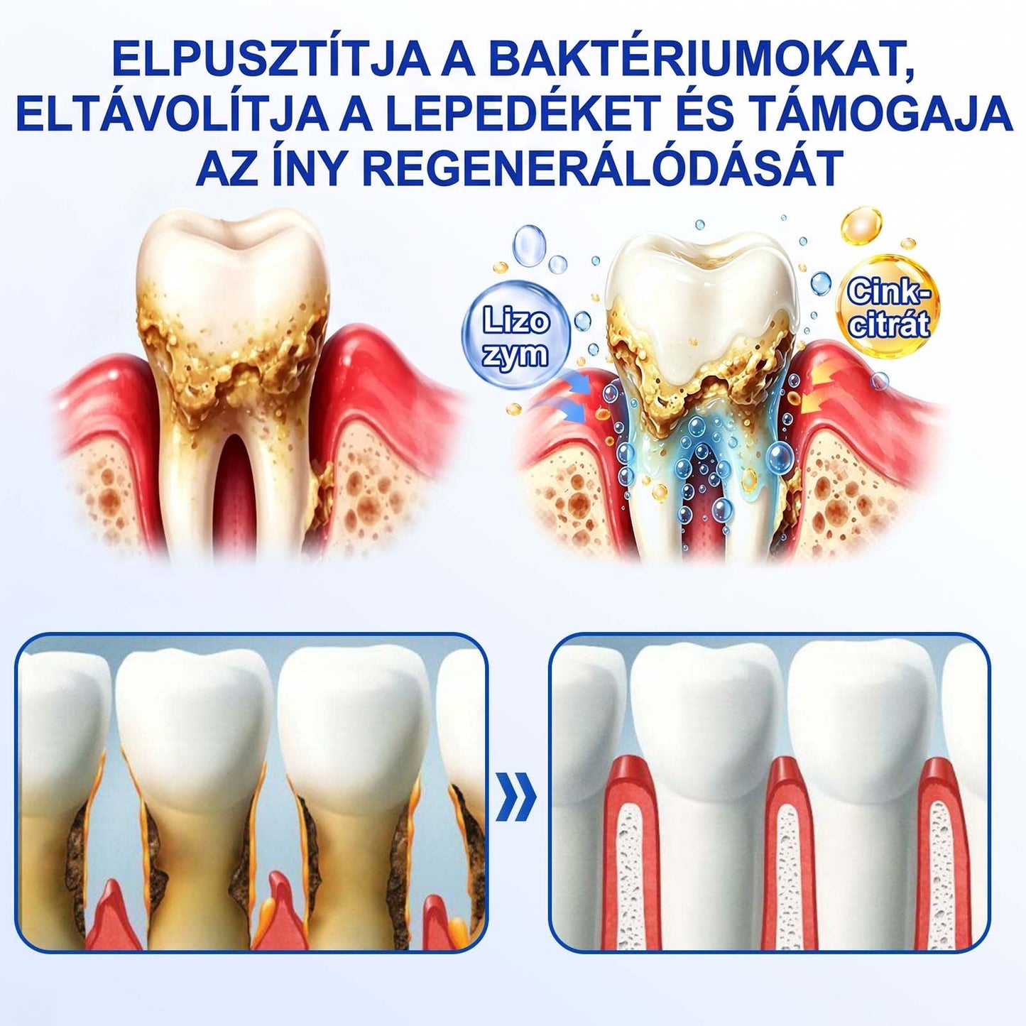 Evolvion® 🦷 GumRevive Ínyregeneráló Gél – Az egészségesebb ínyért és magabiztosabb mosolyért 🥰