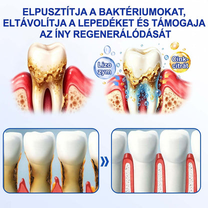 Evolvion® 🦷 GumRevive Ínyregeneráló Gél – Az egészségesebb ínyért és magabiztosabb mosolyért 🥰