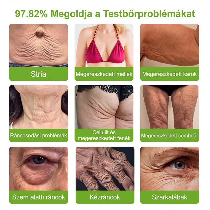 𝑯𝒊𝒔𝒌𝒊𝒏®  𝑷𝑫𝑹𝑵 Ö𝒓𝒆𝒈𝒆𝒅é𝒔𝒈á𝒕𝒍ó & 𝑪é𝒍𝒛𝒐𝒕𝒕 𝑭𝒐𝒍𝒕𝒎𝒆𝒈ú𝒋í𝒕ó 𝑺𝒕𝒊𝒇𝒕（𝑺𝒆𝒈í𝒕 𝒌𝒊𝒔𝒊𝒎í𝒕𝒂𝒏𝒊 𝒂 𝒓á𝒏𝒄𝒐𝒌 𝒎𝒆𝒈𝒋𝒆𝒍𝒆𝒏é𝒔é𝒕, 𝒕á𝒎𝒐𝒈𝒂𝒕𝒋𝒂 𝒂 𝒇𝒆𝒔𝒛𝒆𝒔𝒆𝒃𝒃𝒏𝒆𝒌 𝒕ű𝒏ő 𝒃ő𝒓𝒕, é𝒔 𝒔𝒆𝒈í𝒕 𝒋𝒂𝒗í𝒕𝒂𝒏𝒊 𝒂 𝒍á𝒕𝒉𝒂𝒕ó 𝒇𝒐𝒍𝒕𝒐𝒌 𝒎𝒆𝒈𝒋𝒆𝒍𝒆𝒏é𝒔é𝒕）🍈