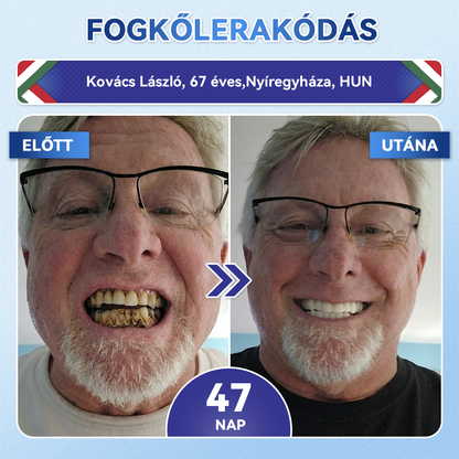 🦷 𝐆𝐥𝐢𝐦𝐦𝐞𝐫𝐥𝐲® 𝐓𝐢𝐝𝐞𝐠𝐥𝐮𝐬𝐢𝐛 Fog- és Ínyregeneráló Mikrotűs Párna | Fejlett Őssejtes Aktiválás Fogfehérítő Csíkok (🦷 Fogzománc és Dentin Újraépítése • Ínyerősítés • Fogatlanodás és Szageltávolítás • Fogérzékenység Megállítása)🐊