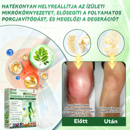 🔥Hivatalos bolt  |  👩‍⚕️𝑳𝒖𝒙𝒂𝒓𝒊𝒔𝒆® MORINGA X BERBERIN 10-IN-1 Haladó Nano Mikrotük Tapasz(Egy naponta, látható változások 7 nap alatt) ✅  Tartalmazza az elhízást, a cukorbetegséget, az alvási apnoét, az ízületi problémákat és egyebeket📦