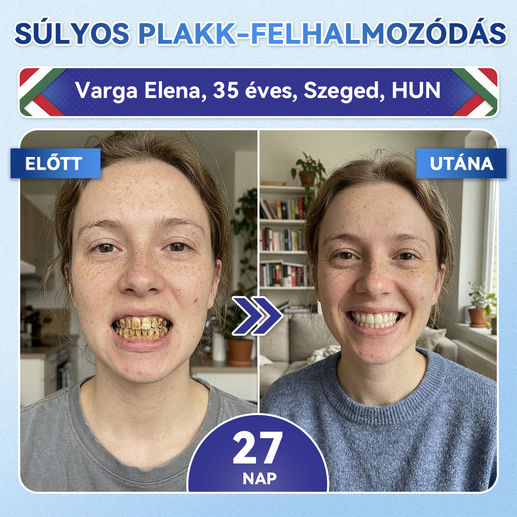 🦷 𝐆𝐥𝐢𝐦𝐦𝐞𝐫𝐥𝐲® 𝐓𝐢𝐝𝐞𝐠𝐥𝐮𝐬𝐢𝐛 Fog- és Ínyregeneráló Mikrotűs Párna | Fejlett Őssejtes Aktiválás Fogfehérítő Csíkok (🦷 Fogzománc és Dentin Újraépítése • Ínyerősítés • Fogatlanodás és Szageltávolítás • Fogérzékenység Megállítása)🐊