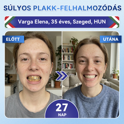 🦷 𝐆𝐥𝐢𝐦𝐦𝐞𝐫𝐥𝐲® 𝐓𝐢𝐝𝐞𝐠𝐥𝐮𝐬𝐢𝐛 Fog- és Ínyregeneráló Mikrotűs Párna | Fejlett Őssejtes Aktiválás Fogfehérítő Csíkok (🦷 Fogzománc és Dentin Újraépítése • Ínyerősítés • Fogatlanodás és Szageltávolítás • Fogérzékenység Megállítása)🐊