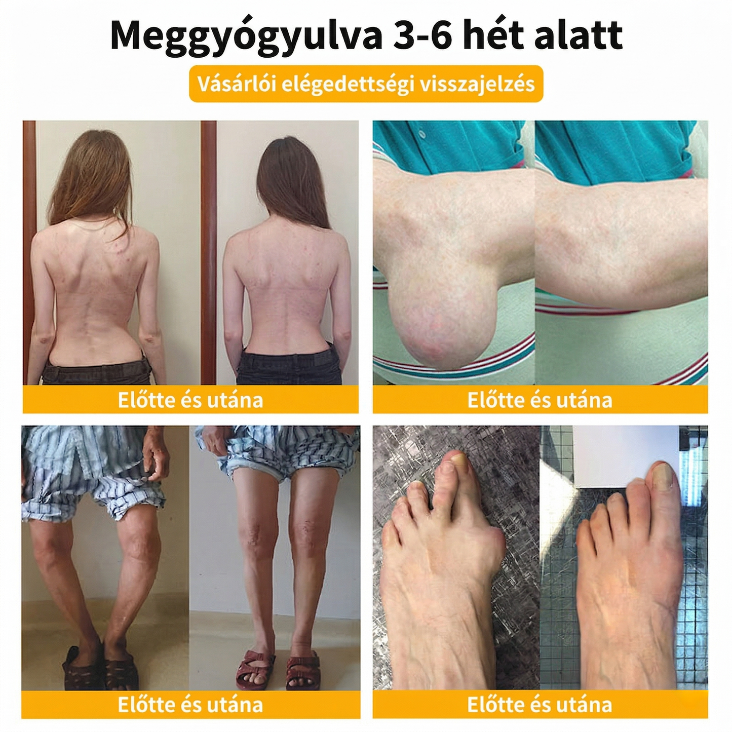 ✅𝐇𝐢𝐯𝐚𝐭𝐚𝐥𝐨𝐬 á𝐫𝐮𝐡á𝐳: 𝑭𝑨𝑻𝑶𝑵𝑮® 𝑩𝒆𝒆 𝑽𝒆𝒏𝒐𝒎 𝑷𝒂𝒊𝒏-𝑹𝒆𝒍𝒊𝒆𝒇 𝑩𝒐𝒏𝒆 𝑯𝒆𝒂𝒍𝒊𝒏𝒈 𝑪𝒓𝒆𝒂𝒎 𝑨‍⚕️ 𝐀𝐳 𝐀𝐦𝐞𝐫𝐢𝐤𝐚𝐢 𝐎𝐫𝐭𝐨𝐩é𝐝 𝐒𝐞𝐛é𝐬𝐳𝐞𝐭𝐢 𝐀𝐤𝐚𝐝é𝐦𝐢𝐚 (𝐀𝐀𝐎𝐒) 𝐚𝐣á𝐧𝐥á𝐬á𝐯𝐚𝐥 💖 𝐊𝐨𝐫𝐥á𝐭𝐨𝐳𝐨𝐭𝐭 𝐢𝐝𝐞𝐢𝐠 é𝐫𝐯é𝐧𝐲𝐞𝐬 𝐚𝐤𝐜𝐢ó 🔥