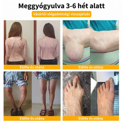 ✅𝐇𝐢𝐯𝐚𝐭𝐚𝐥𝐨𝐬 á𝐫𝐮𝐡á𝐳: 𝑭𝑨𝑻𝑶𝑵𝑮® 𝑩𝒆𝒆 𝑽𝒆𝒏𝒐𝒎 𝑷𝒂𝒊𝒏-𝑹𝒆𝒍𝒊𝒆𝒇 𝑩𝒐𝒏𝒆 𝑯𝒆𝒂𝒍𝒊𝒏𝒈 𝑪𝒓𝒆𝒂𝒎 𝑨‍⚕️ 𝐀𝐳 𝐀𝐦𝐞𝐫𝐢𝐤𝐚𝐢 𝐎𝐫𝐭𝐨𝐩é𝐝 𝐒𝐞𝐛é𝐬𝐳𝐞𝐭𝐢 𝐀𝐤𝐚𝐝é𝐦𝐢𝐚 (𝐀𝐀𝐎𝐒) 𝐚𝐣á𝐧𝐥á𝐬á𝐯𝐚𝐥 💖 𝐊𝐨𝐫𝐥á𝐭𝐨𝐳𝐨𝐭𝐭 𝐢𝐝𝐞𝐢𝐠 é𝐫𝐯é𝐧𝐲𝐞𝐬 𝐚𝐤𝐜𝐢ó 🔥