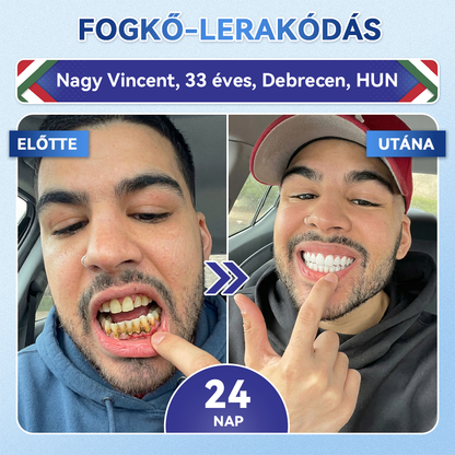 🦷 𝐆𝐥𝐢𝐦𝐦𝐞𝐫𝐥𝐲® 𝐓𝐢𝐝𝐞𝐠𝐥𝐮𝐬𝐢𝐛 Fog- és Ínyregeneráló Mikrotűs Párna | Fejlett Őssejtes Aktiválás Fogfehérítő Csíkok (🦷 Fogzománc és Dentin Újraépítése • Ínyerősítés • Fogatlanodás és Szageltávolítás • Fogérzékenység Megállítása)🐊