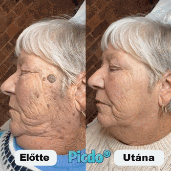 𝐏𝐢𝐜𝐝𝐨® 𝟕 𝐍𝐚𝐩𝐨𝐬 𝐓𝐚𝐠 𝐞́𝐬 𝐒𝐩𝐨𝐭 𝐄𝐥𝐭𝐚́𝐯𝐨𝐥𝐢́𝐭𝐨́ (𝐑𝐨𝐥𝐥-𝐨𝐧 𝐚𝐩𝐩𝐥𝐢𝐤𝐚́𝐭𝐨𝐫: 𝐟𝐚́𝐣𝐝𝐚𝐥𝐨𝐦 𝐞́𝐬 𝐡𝐞𝐠𝐞𝐤 𝐧𝐞́𝐥𝐤𝐮̈𝐥)😍