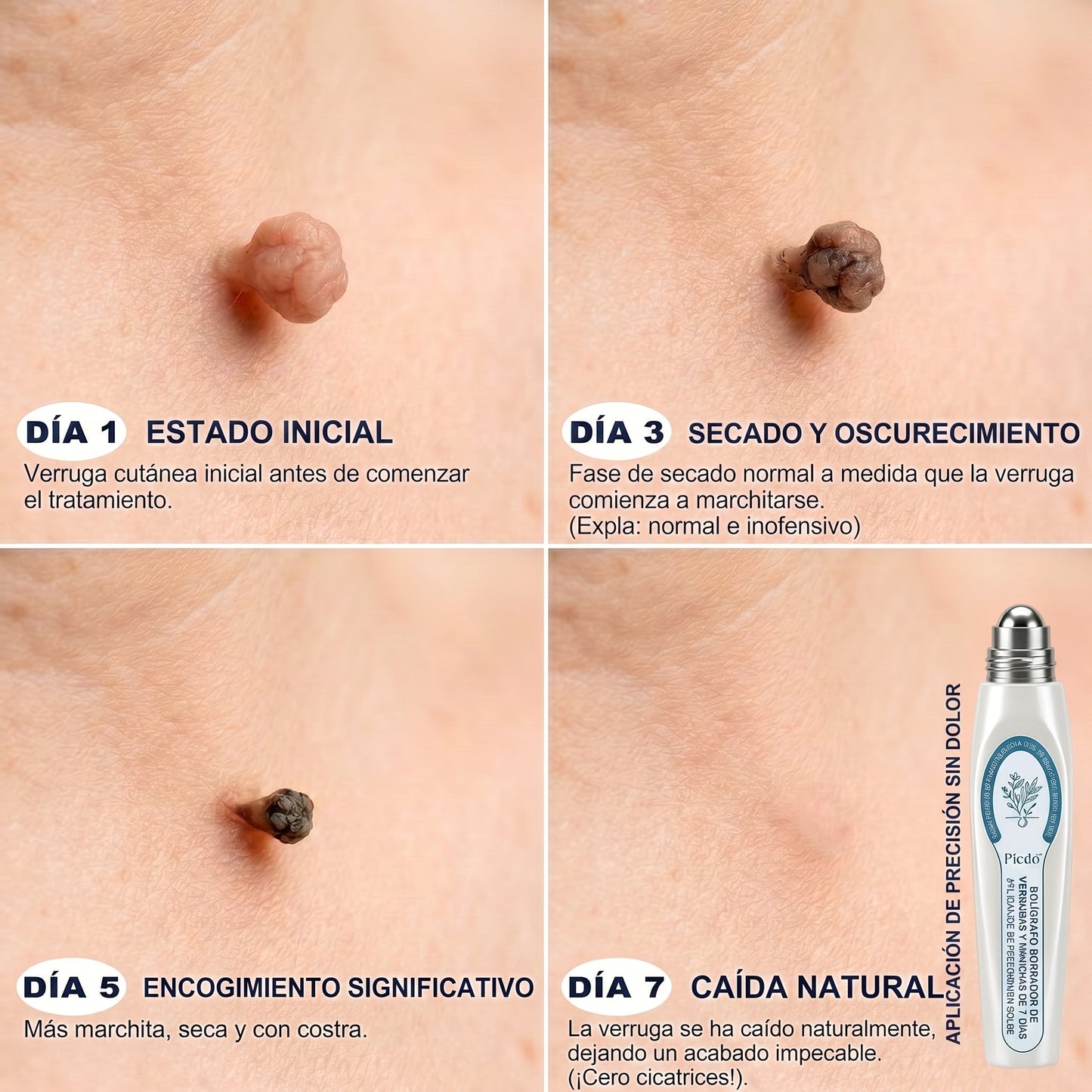 𝐏𝐢𝐜𝐝𝐨® 𝟕 𝐍𝐚𝐩𝐨𝐬 𝐓𝐚𝐠 𝐞́𝐬 𝐒𝐩𝐨𝐭 𝐄𝐥𝐭𝐚́𝐯𝐨𝐥𝐢́𝐭𝐨́ (𝐑𝐨𝐥𝐥-𝐨𝐧 𝐚𝐩𝐩𝐥𝐢𝐤𝐚́𝐭𝐨𝐫: 𝐟𝐚́𝐣𝐝𝐚𝐥𝐨𝐦 𝐞́𝐬 𝐡𝐞𝐠𝐞𝐤 𝐧𝐞́𝐥𝐤𝐮̈𝐥)