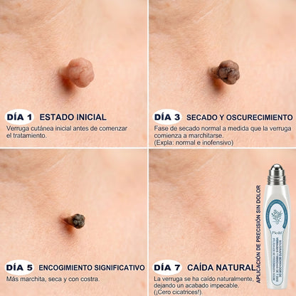 𝐏𝐢𝐜𝐝𝐨® 𝟕 𝐍𝐚𝐩𝐨𝐬 𝐓𝐚𝐠 𝐞́𝐬 𝐒𝐩𝐨𝐭 𝐄𝐥𝐭𝐚́𝐯𝐨𝐥𝐢́𝐭𝐨́ (𝐑𝐨𝐥𝐥-𝐨𝐧 𝐚𝐩𝐩𝐥𝐢𝐤𝐚́𝐭𝐨𝐫: 𝐟𝐚́𝐣𝐝𝐚𝐥𝐨𝐦 𝐞́𝐬 𝐡𝐞𝐠𝐞𝐤 𝐧𝐞́𝐥𝐤𝐮̈𝐥)