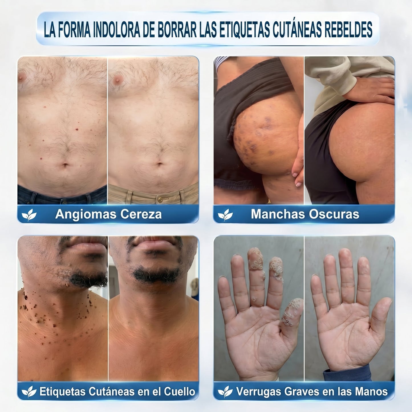 𝐏𝐢𝐜𝐝𝐨® 𝟕 𝐍𝐚𝐩𝐨𝐬 𝐓𝐚𝐠 𝐞́𝐬 𝐒𝐩𝐨𝐭 𝐄𝐥𝐭𝐚́𝐯𝐨𝐥𝐢́𝐭𝐨́ (𝐑𝐨𝐥𝐥-𝐨𝐧 𝐚𝐩𝐩𝐥𝐢𝐤𝐚́𝐭𝐨𝐫: 𝐟𝐚́𝐣𝐝𝐚𝐥𝐨𝐦 𝐞́𝐬 𝐡𝐞𝐠𝐞𝐤 𝐧𝐞́𝐥𝐤𝐮̈𝐥)