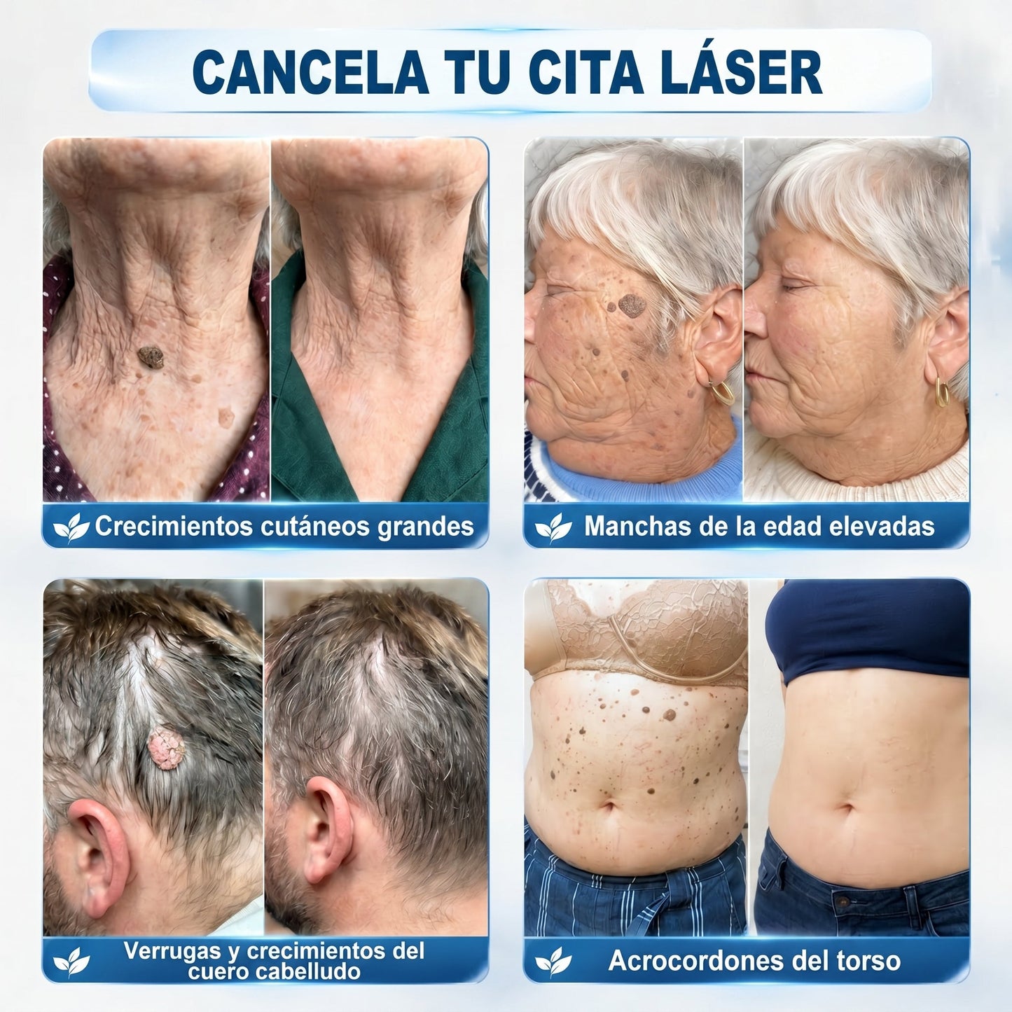 𝐏𝐢𝐜𝐝𝐨® 𝟕 𝐍𝐚𝐩𝐨𝐬 𝐓𝐚𝐠 𝐞́𝐬 𝐒𝐩𝐨𝐭 𝐄𝐥𝐭𝐚́𝐯𝐨𝐥𝐢́𝐭𝐨́ (𝐑𝐨𝐥𝐥-𝐨𝐧 𝐚𝐩𝐩𝐥𝐢𝐤𝐚́𝐭𝐨𝐫: 𝐟𝐚́𝐣𝐝𝐚𝐥𝐨𝐦 𝐞́𝐬 𝐡𝐞𝐠𝐞𝐤 𝐧𝐞́𝐥𝐤𝐮̈𝐥)