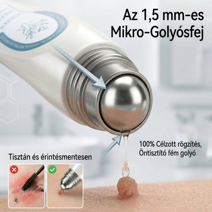 𝐏𝐢𝐜𝐝𝐨® 𝟕 𝐍𝐚𝐩𝐨𝐬 𝐓𝐚𝐠 𝐞́𝐬 𝐒𝐩𝐨𝐭 𝐄𝐥𝐭𝐚́𝐯𝐨𝐥𝐢́𝐭𝐨́ (𝐑𝐨𝐥𝐥-𝐨𝐧 𝐚𝐩𝐩𝐥𝐢𝐤𝐚́𝐭𝐨𝐫: 𝐟𝐚́𝐣𝐝𝐚𝐥𝐨𝐦 𝐞́𝐬 𝐡𝐞𝐠𝐞𝐤 𝐧𝐞́𝐥𝐤𝐮̈𝐥)😍