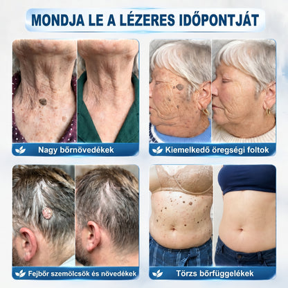 𝐏𝐢𝐜𝐝𝐨® 𝟕 𝐍𝐚𝐩𝐨𝐬 𝐓𝐚𝐠 𝐞́𝐬 𝐒𝐩𝐨𝐭 𝐄𝐥𝐭𝐚́𝐯𝐨𝐥𝐢́𝐭𝐨́ (𝐑𝐨𝐥𝐥-𝐨𝐧 𝐚𝐩𝐩𝐥𝐢𝐤𝐚́𝐭𝐨𝐫: 𝐟𝐚́𝐣𝐝𝐚𝐥𝐨𝐦 𝐞́𝐬 𝐡𝐞𝐠𝐞𝐤 𝐧𝐞́𝐥𝐤𝐮̈𝐥)😍