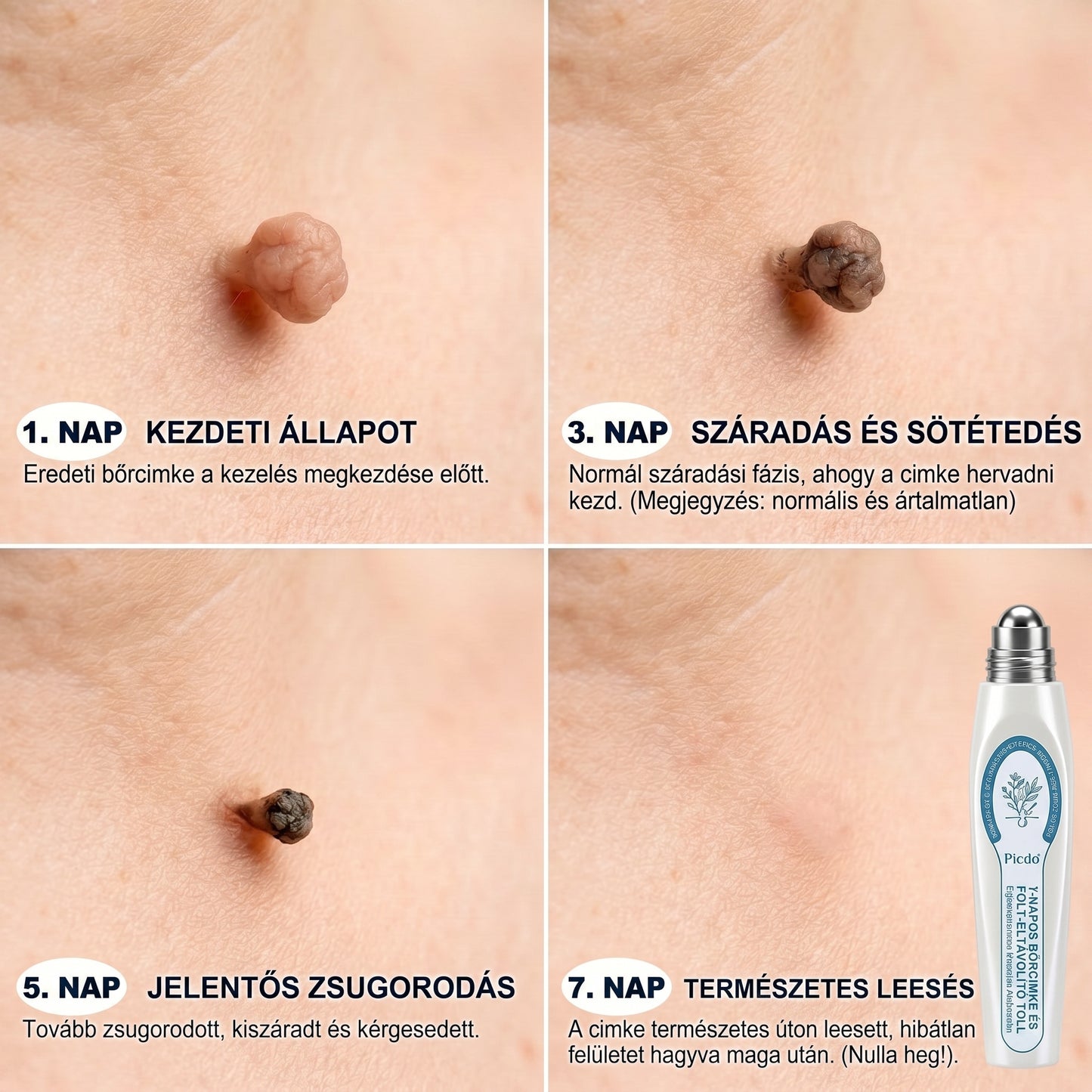 𝐏𝐢𝐜𝐝𝐨® 𝟕 𝐍𝐚𝐩𝐨𝐬 𝐓𝐚𝐠 𝐞́𝐬 𝐒𝐩𝐨𝐭 𝐄𝐥𝐭𝐚́𝐯𝐨𝐥𝐢́𝐭𝐨́ (𝐑𝐨𝐥𝐥-𝐨𝐧 𝐚𝐩𝐩𝐥𝐢𝐤𝐚́𝐭𝐨𝐫: 𝐟𝐚́𝐣𝐝𝐚𝐥𝐨𝐦 𝐞́𝐬 𝐡𝐞𝐠𝐞𝐤 𝐧𝐞́𝐥𝐤𝐮̈𝐥)😍