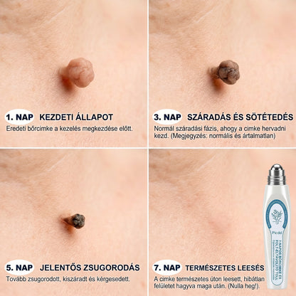 𝐏𝐢𝐜𝐝𝐨® 𝟕 𝐍𝐚𝐩𝐨𝐬 𝐓𝐚𝐠 𝐞́𝐬 𝐒𝐩𝐨𝐭 𝐄𝐥𝐭𝐚́𝐯𝐨𝐥𝐢́𝐭𝐨́ (𝐑𝐨𝐥𝐥-𝐨𝐧 𝐚𝐩𝐩𝐥𝐢𝐤𝐚́𝐭𝐨𝐫: 𝐟𝐚́𝐣𝐝𝐚𝐥𝐨𝐦 𝐞́𝐬 𝐡𝐞𝐠𝐞𝐤 𝐧𝐞́𝐥𝐤𝐮̈𝐥)😍