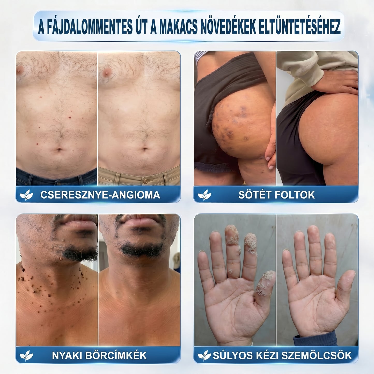 𝐏𝐢𝐜𝐝𝐨® 𝟕 𝐍𝐚𝐩𝐨𝐬 𝐓𝐚𝐠 𝐞́𝐬 𝐒𝐩𝐨𝐭 𝐄𝐥𝐭𝐚́𝐯𝐨𝐥𝐢́𝐭𝐨́ (𝐑𝐨𝐥𝐥-𝐨𝐧 𝐚𝐩𝐩𝐥𝐢𝐤𝐚́𝐭𝐨𝐫: 𝐟𝐚́𝐣𝐝𝐚𝐥𝐨𝐦 𝐞́𝐬 𝐡𝐞𝐠𝐞𝐤 𝐧𝐞́𝐥𝐤𝐮̈𝐥)😍
