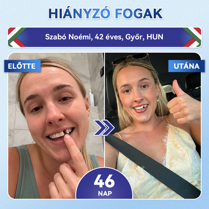 🦷 𝐆𝐥𝐢𝐦𝐦𝐞𝐫𝐥𝐲® 𝐓𝐢𝐝𝐞𝐠𝐥𝐮𝐬𝐢𝐛 Fog- és Ínyregeneráló Mikrotűs Párna | Fejlett Őssejtes Aktiválás Fogfehérítő Csíkok (🦷 Fogzománc és Dentin Újraépítése • Ínyerősítés • Fogatlanodás és Szageltávolítás • Fogérzékenység Megállítása)🐊