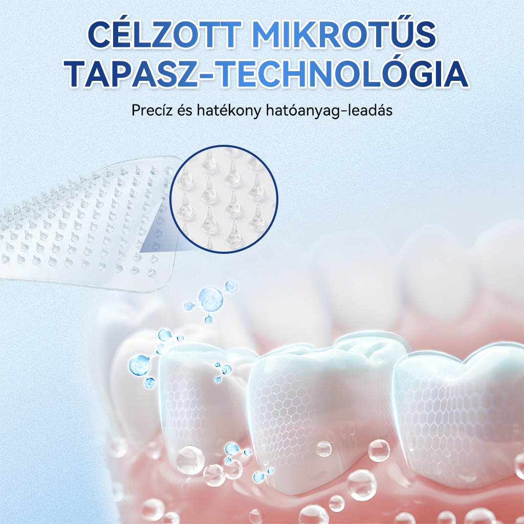 🦷 𝐆𝐥𝐢𝐦𝐦𝐞𝐫𝐥𝐲® 𝐓𝐢𝐝𝐞𝐠𝐥𝐮𝐬𝐢𝐛 Fog- és Ínyregeneráló Mikrotűs Párna | Fejlett Őssejtes Aktiválás Fogfehérítő Csíkok (🦷 Fogzománc és Dentin Újraépítése • Ínyerősítés • Fogatlanodás és Szageltávolítás • Fogérzékenység Megállítása)🐊